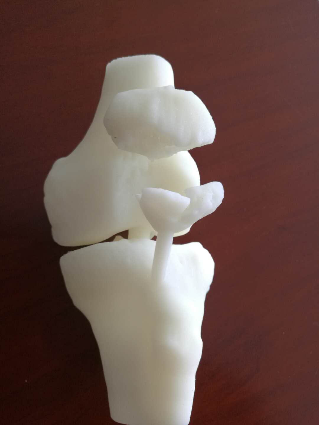 3D 打印个性化定制医用模型